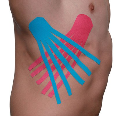 5 kinesio rebra foto