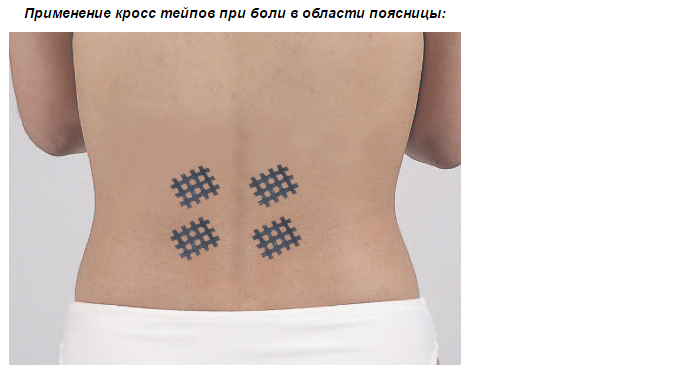 crosstape11