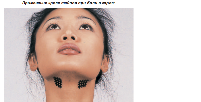 crosstape12