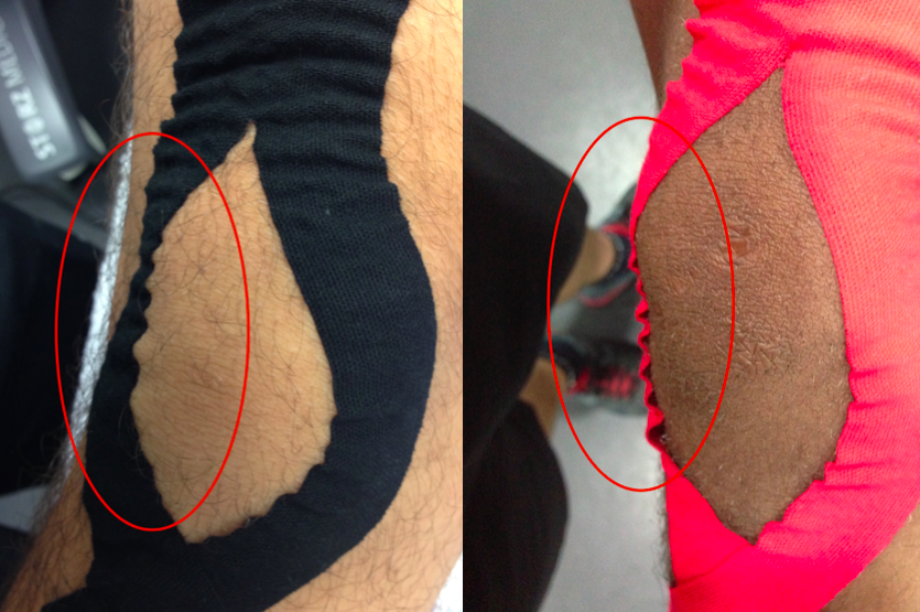 kinesio football13