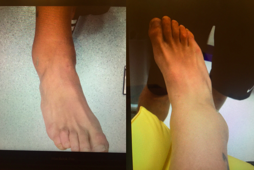 kinesio football14