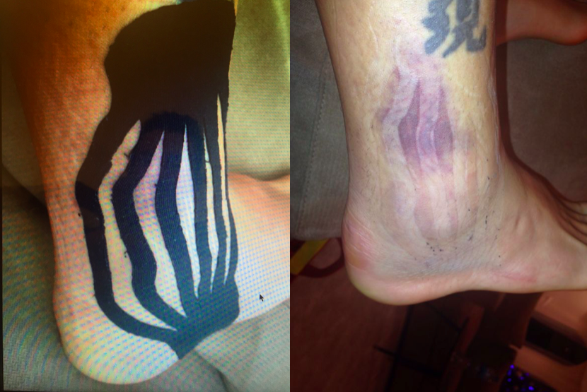 kinesio football15