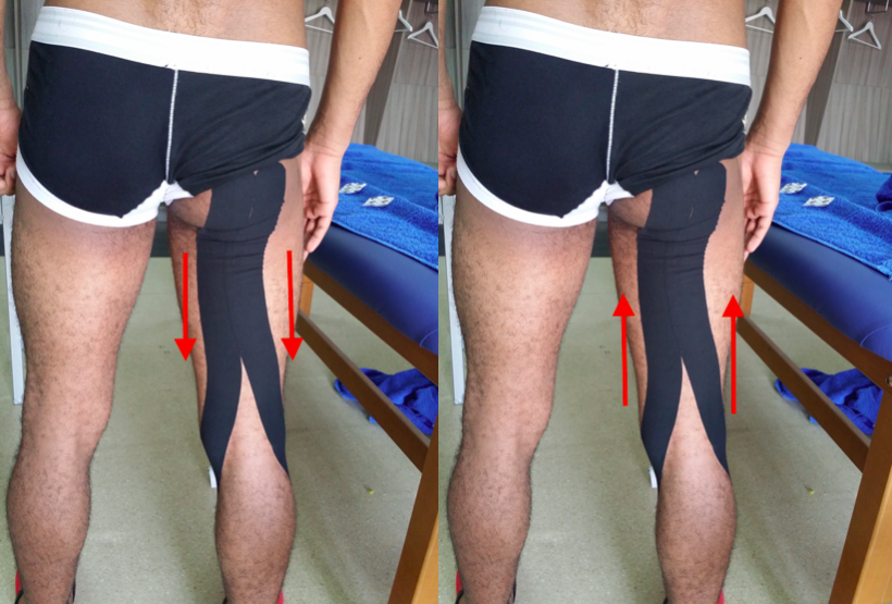 kinesio football6