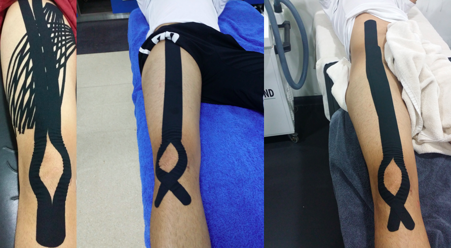 kinesio football9